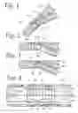 Fig. 02 - Extendible stent apparatus
