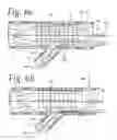 Fig. 04 - Extendible stent apparatus