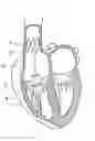 Application 20060241745, fig. 01