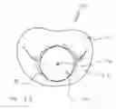 Fig. 18 - Blood flow controlling apparatus