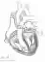 Fig. 22 - Blood flow controlling apparatus