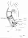 Fig. 25 - Blood flow controlling apparatus