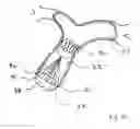 Fig. 28 - Blood flow controlling apparatus