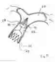 Fig. 30 - Blood flow controlling apparatus