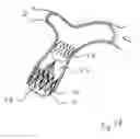 Fig. 31 - Blood flow controlling apparatus