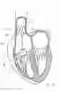 Fig. 33 - Blood flow controlling apparatus
