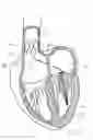 Fig. 34 - Blood flow controlling apparatus