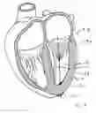 Fig. 41 - Blood flow controlling apparatus