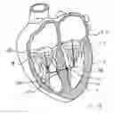 Fig. 42 - Blood flow controlling apparatus