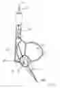 Fig. 53 - Blood flow controlling apparatus