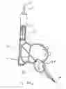 Fig. 57 - Blood flow controlling apparatus
