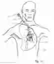 Fig. 58 - Blood flow controlling apparatus