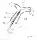 Fig. 59 - Blood flow controlling apparatus
