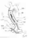 Fig. 63 - Blood flow controlling apparatus