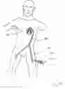 Fig. 66 - Blood flow controlling apparatus