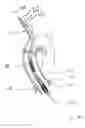 Fig. 67 - Blood flow controlling apparatus