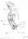 Fig. 69 - Blood flow controlling apparatus
