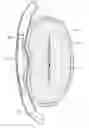Fig. 01 - Dynamically adjustable implants and methods for reshaping tissue