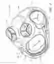 Fig. 02 - Dynamically adjustable implants and methods for reshaping tissue