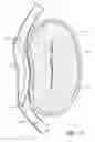 Fig. 07 - Dynamically adjustable implants and methods for reshaping tissue
