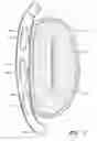 Fig. 09 - Dynamically adjustable implants and methods for reshaping tissue