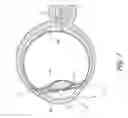 Fig. 02 - Implant delivery system and methods thereof for treating ocular disorders