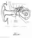 Fig. 02 - Stapedial Prosthesis and Method of Implanting the Same