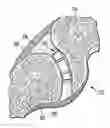 Fig. 01 - Facet spacers