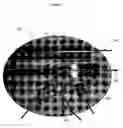 Fig. 03 - Oriented polymeric spinal implants