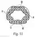 Fig. 07 - Spinal implant