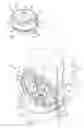 Fig. 02 - Method and apparatus for preventing articulation in an artificial joint