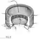 Fig. 09 - Spinal disc prosthesis and methods of use