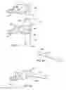 Fig. 10 - Artificial functional spinal unit system and method for use