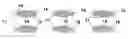 Fig. 01 - Physiologically movable intervertebral disc prosthesis for the lumbar and cervical spine