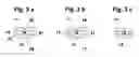 Fig. 04 - Physiologically movable intervertebral disc prosthesis for the lumbar and cervical spine