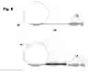 Fig. 09 - Physiologically movable intervertebral disc prosthesis for the lumbar and cervical spine