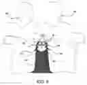 Fig. 06 - Spinal disc annulus reconstruction method and spinal disc annulus stent