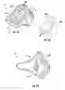 Fig. 02 - Resorbable medical implants and methods