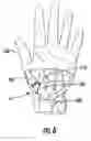 Fig. 06 - Resorbable medical implants and methods
