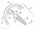 Fig. 01 - Modular resurfacing prosthetic