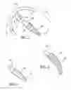 Fig. 02 - Modular resurfacing prosthetic