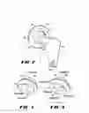 Fig. 05 - VARIABLE GEOMETRY RIM SURFACE ACETABULAR SHELL LINER