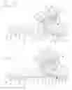 Fig. 06 - Vertical shock absorbing prosthetic foot