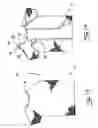Fig. 09 - Two-piece garment