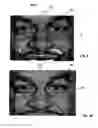 Fig. 07 - Mask apparatus