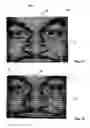 Fig. 08 - Mask apparatus
