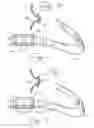 Fig. 04 - Buckle