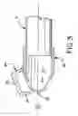 Fig. 04 - Hand tool for removing push nuts