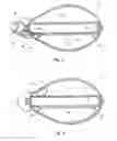 Fig. 04 - Decoy weight