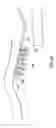 Fig. 07 - LED lighting apparatus and method of using same for illumination of a body cavity